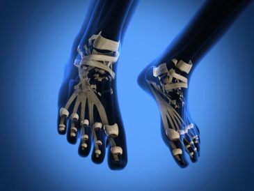 Turnips Ease Pain in Heel Image